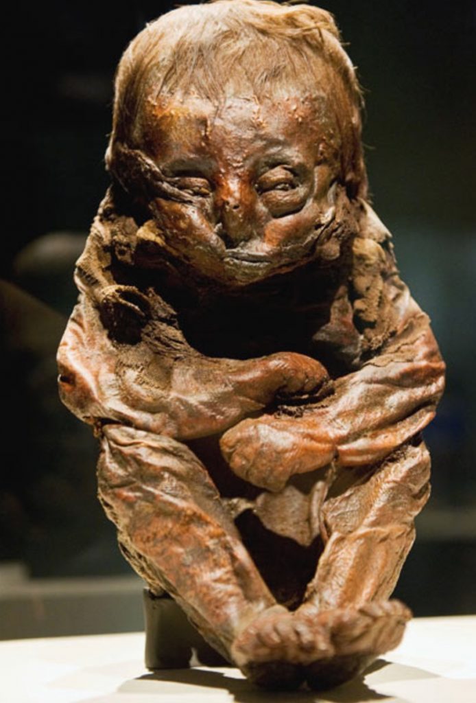 The Detmold Child (Mummies of the World)